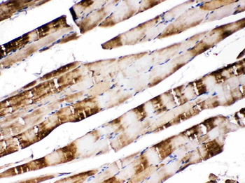 Carbonic Anhydrase III/CA3 Rabbit Polyclonal Antibody