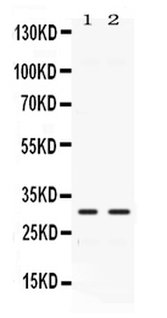 Carbonic Anhydrase III/CA3 Rabbit Polyclonal Antibody