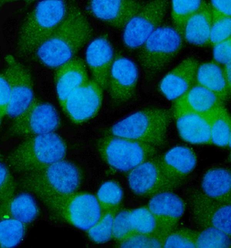 CCDC6 Rabbit Polyclonal Antibody