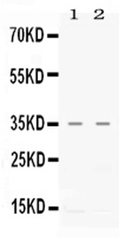 CXCL16 Rabbit Polyclonal Antibody