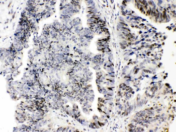 E2F4 Rabbit Polyclonal Antibody