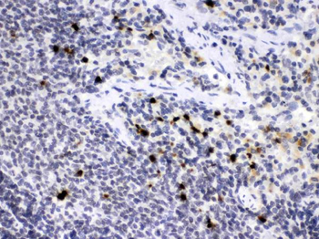 Neutrophil Elastase/ELANE Rabbit Polyclonal Antibody