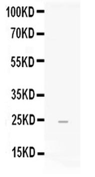 FGF19 Rabbit Polyclonal Antibody