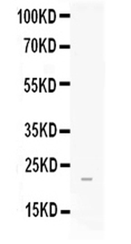 FGF21 Rabbit Polyclonal Antibody