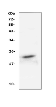 FGF21 Rabbit Polyclonal Antibody