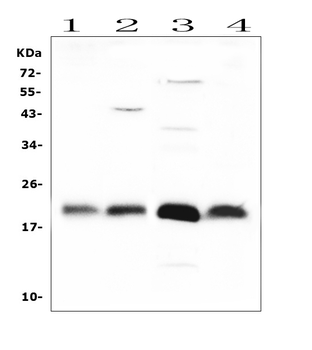 FGF21 Rabbit Polyclonal Antibody