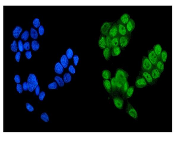 KDM5B/PLU1/Jarid1B Rabbit Polyclonal Antibody