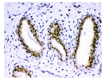KDM5B/PLU1/Jarid1B Rabbit Polyclonal Antibody