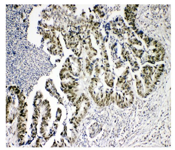 KDM5B/PLU1/Jarid1B Rabbit Polyclonal Antibody