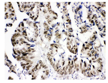 KDM5B/PLU1/Jarid1B Rabbit Polyclonal Antibody