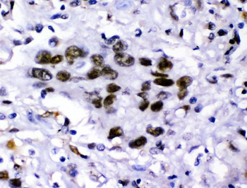 KDM5B/PLU1/Jarid1B Rabbit Polyclonal Antibody