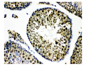 KDM5B/PLU1/Jarid1B Rabbit Polyclonal Antibody