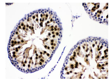 KDM5B/PLU1/Jarid1B Rabbit Polyclonal Antibody