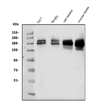 KDM5B/PLU1/Jarid1B Rabbit Polyclonal Antibody