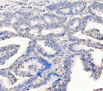 LDHA Rabbit Polyclonal Antibody