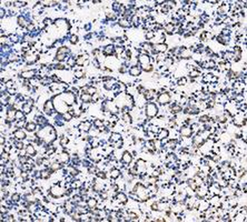 LDHA Rabbit Polyclonal Antibody