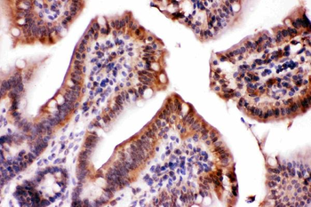LDHA Rabbit Polyclonal Antibody