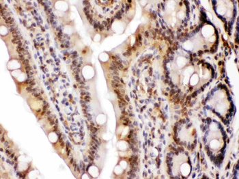 LDHA Rabbit Polyclonal Antibody
