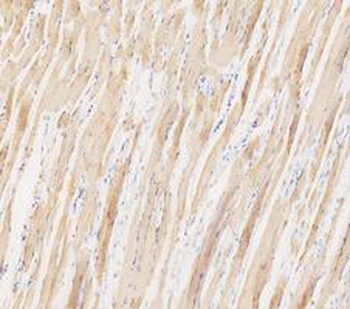 LDHA Rabbit Polyclonal Antibody
