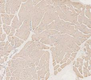 LDHA Rabbit Polyclonal Antibody