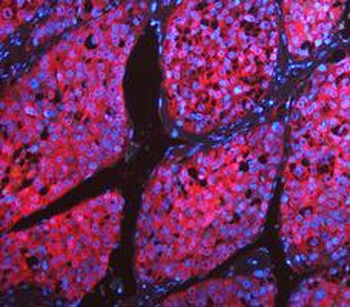 LDHA Rabbit Polyclonal Antibody