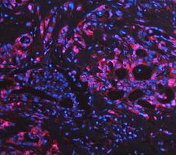 LDHA Rabbit Polyclonal Antibody