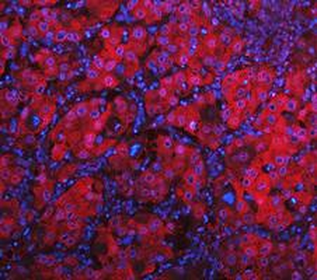 LDHA Rabbit Polyclonal Antibody