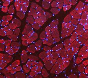 LDHA Rabbit Polyclonal Antibody