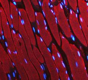LDHA Rabbit Polyclonal Antibody