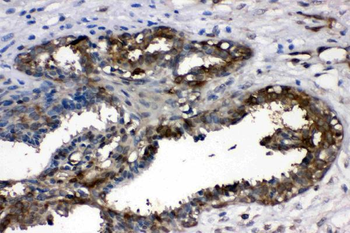 LDHA Rabbit Polyclonal Antibody