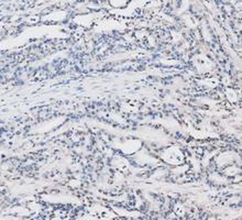 LDHA Rabbit Polyclonal Antibody