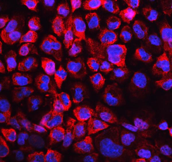 Lactate Dehydrogenase B/LDHB Rabbit Polyclonal Antibody