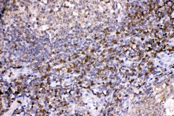 Lactate Dehydrogenase B/LDHB Rabbit Polyclonal Antibody