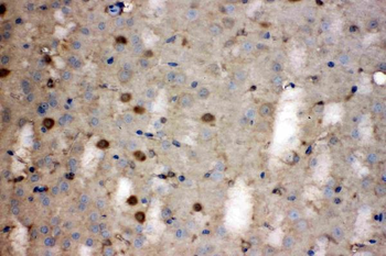 Lactate Dehydrogenase B/LDHB Rabbit Polyclonal Antibody
