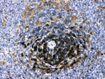 Lactate Dehydrogenase B/LDHB Rabbit Polyclonal Antibody