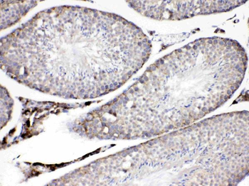 ADFP/PLIN2 Rabbit Polyclonal Antibody