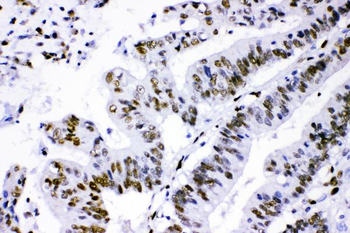 PML Protein Rabbit Polyclonal Antibody