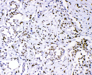 PML Protein Rabbit Polyclonal Antibody