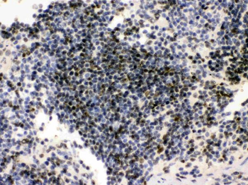 PML Protein Rabbit Polyclonal Antibody