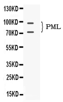 PML Protein Rabbit Polyclonal Antibody