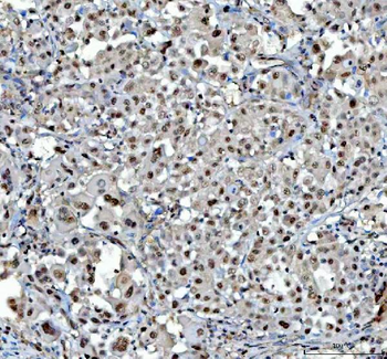Proteasome 20S C2/PSMA1 Rabbit Polyclonal Antibody