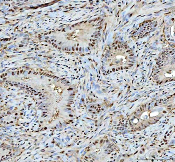 Proteasome 20S C2/PSMA1 Rabbit Polyclonal Antibody