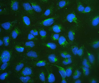 67kDa Laminin Receptor/RPSA Rabbit Polyclonal Antibody