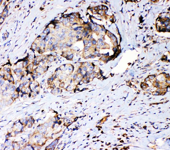 67kDa Laminin Receptor/RPSA Rabbit Polyclonal Antibody