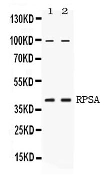 67kDa Laminin Receptor/RPSA Rabbit Polyclonal Antibody