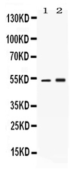 alpha 1 Antitrypsin/SERPINA1 Rabbit Polyclonal Antibody