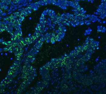 PC4/SUB1 Rabbit Polyclonal Antibody