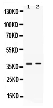 TNFRSF14 Rabbit Polyclonal Antibody