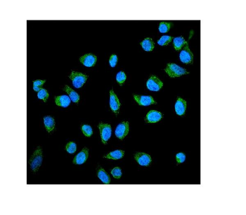 Placental alkaline phosphatase/ALPP Rabbit Polyclonal Antibody