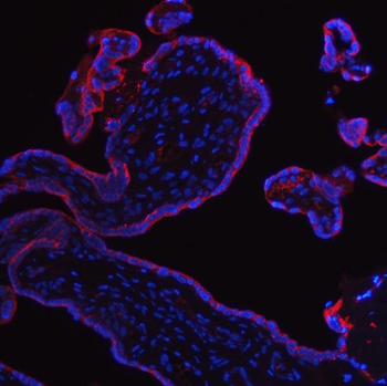 Placental alkaline phosphatase/ALPP Rabbit Polyclonal Antibody
